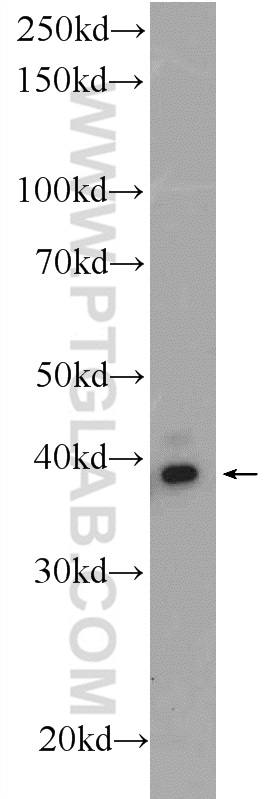 PCGF6 Polyclonal antibody
