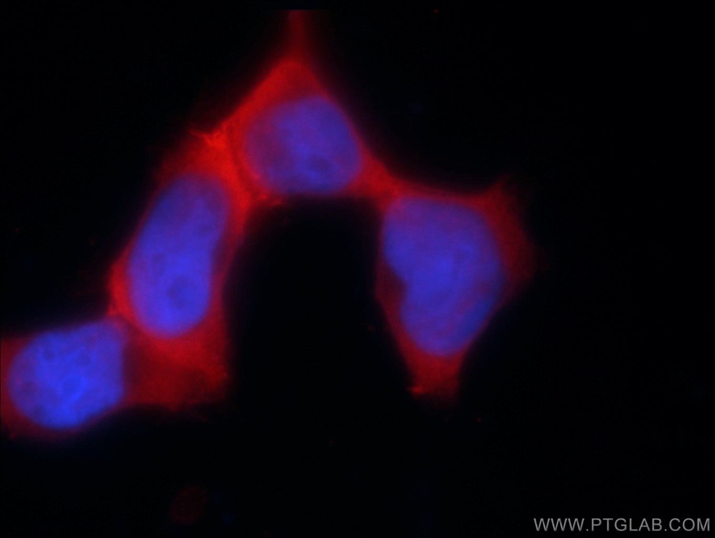 PSMC3 Polyclonal antibody