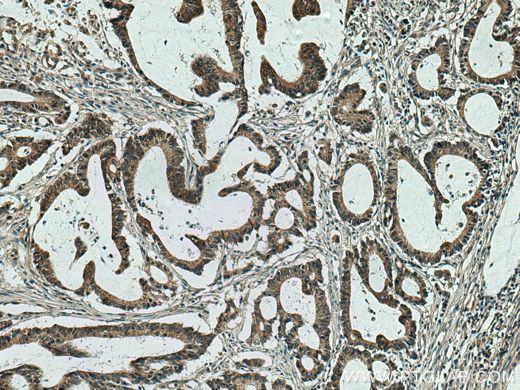 JNK Polyclonal antibody
