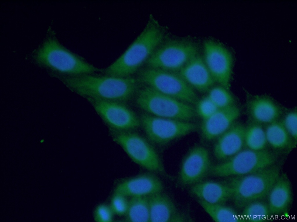 IL-28B/ IFNL3 Polyclonal antibody