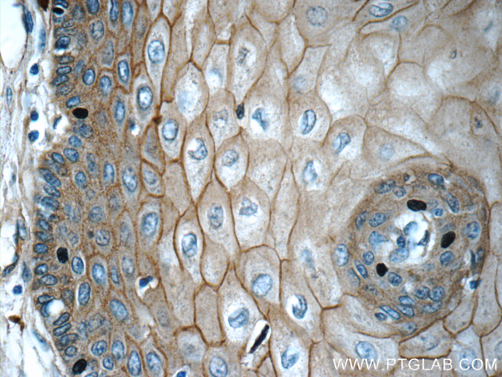 GJB6 Polyclonal antibody