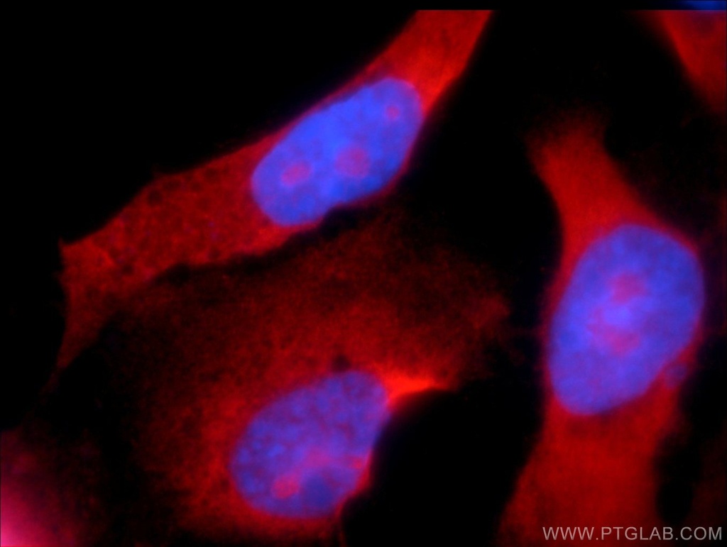 CCDC104 Polyclonal antibody