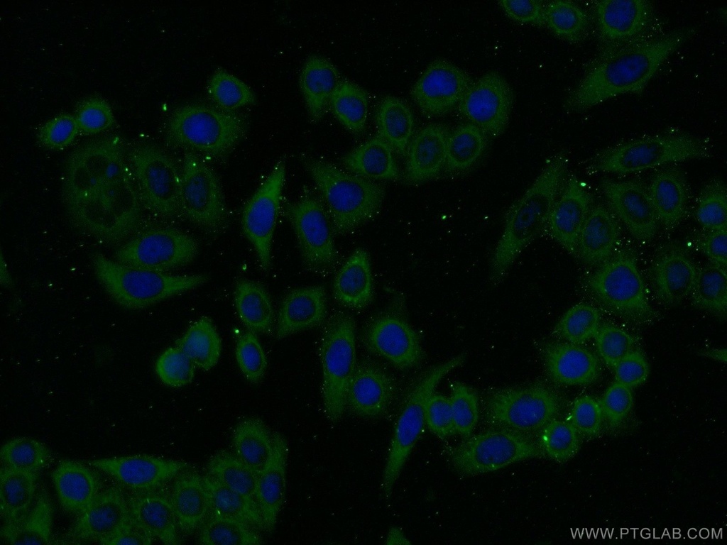 PHKA1 Polyclonal antibody