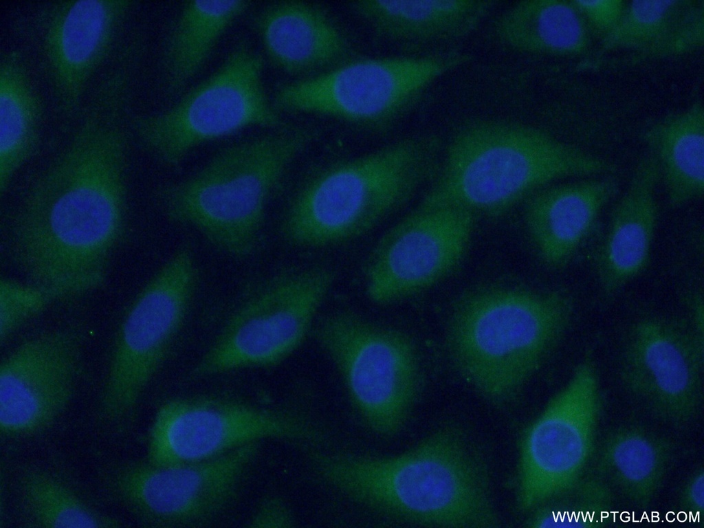 F2 Polyclonal antibody