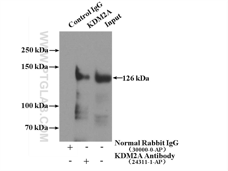 KDM2A Polyclonal antibody