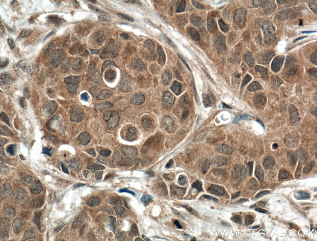 DGKB Polyclonal antibody