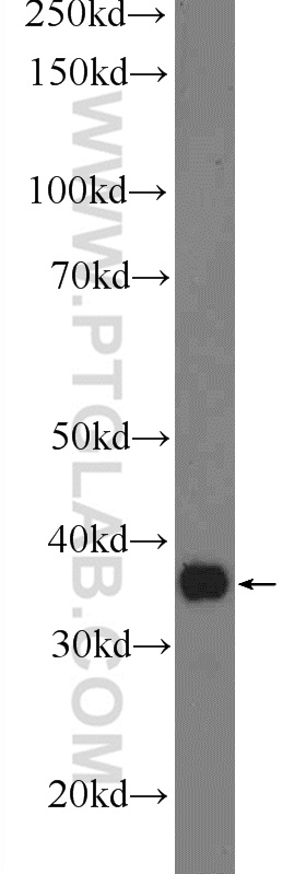 ACPT Polyclonal antibody