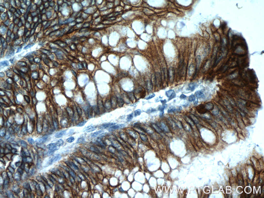 Cadherin-17 Polyclonal antibody