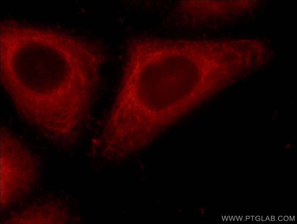 ERP29 Polyclonal antibody