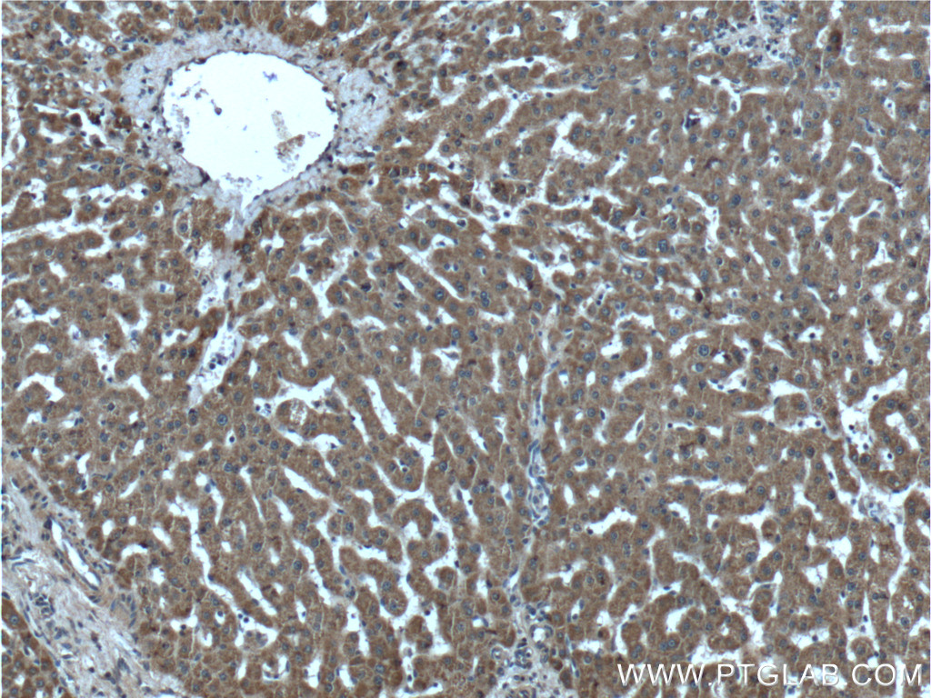 ABCA8 Polyclonal antibody