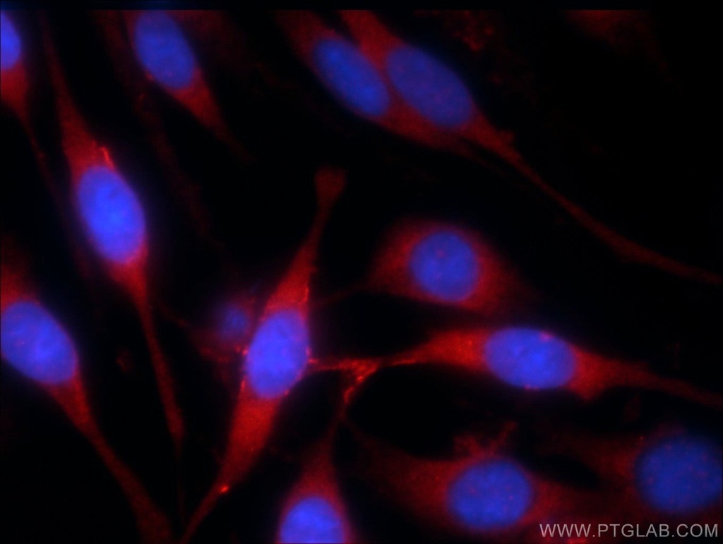 MLK4 Polyclonal antibody