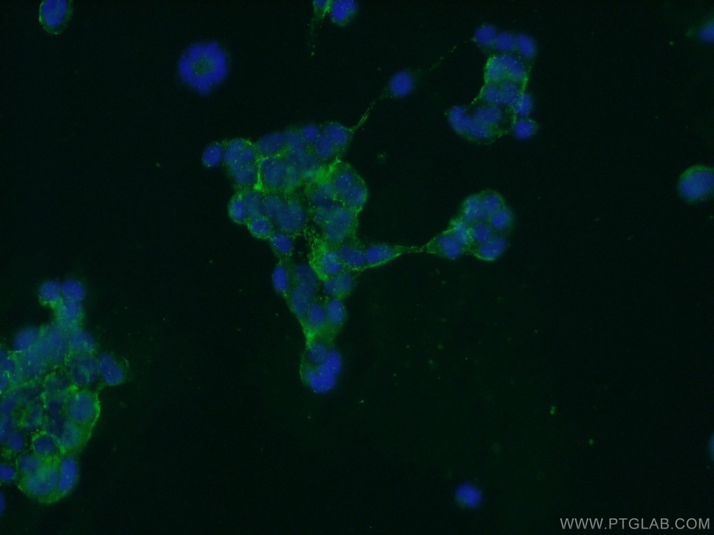 GPATCH4 Polyclonal antibody
