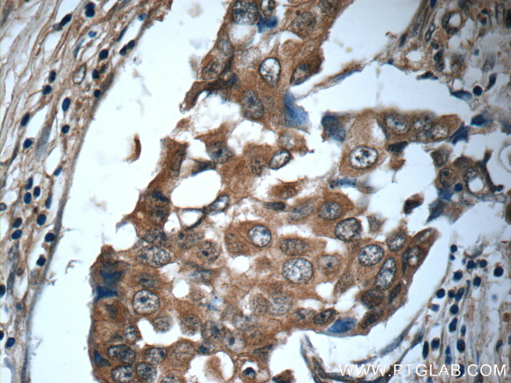 IL-19 Polyclonal antibody