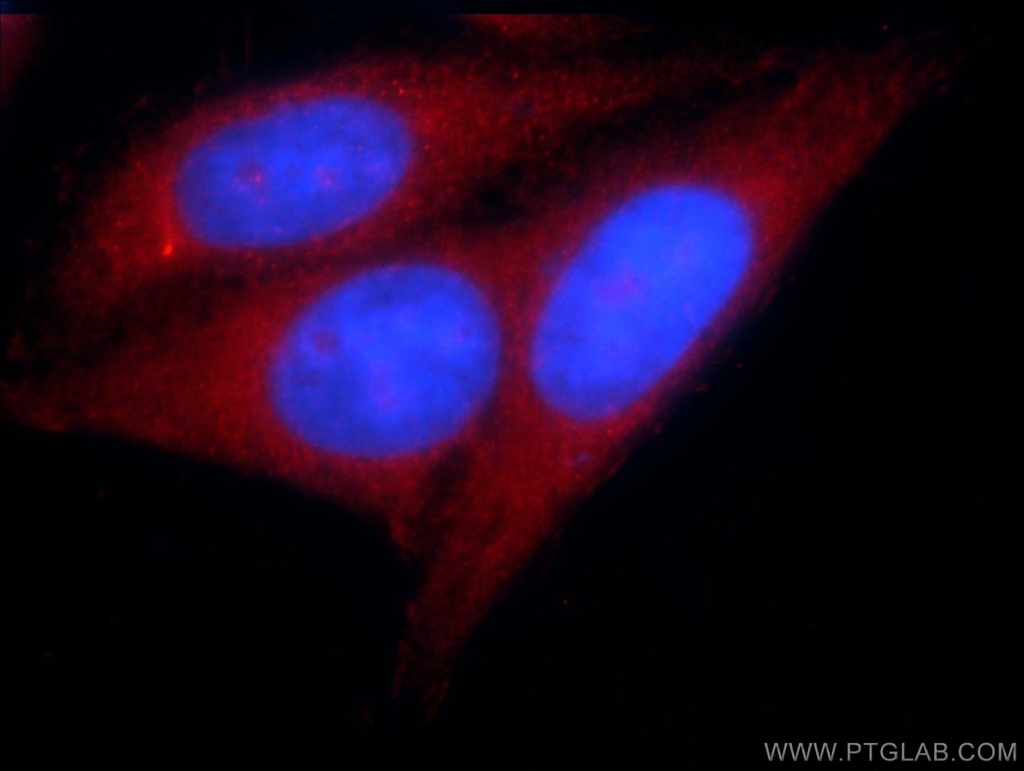 KTELC1 Polyclonal antibody