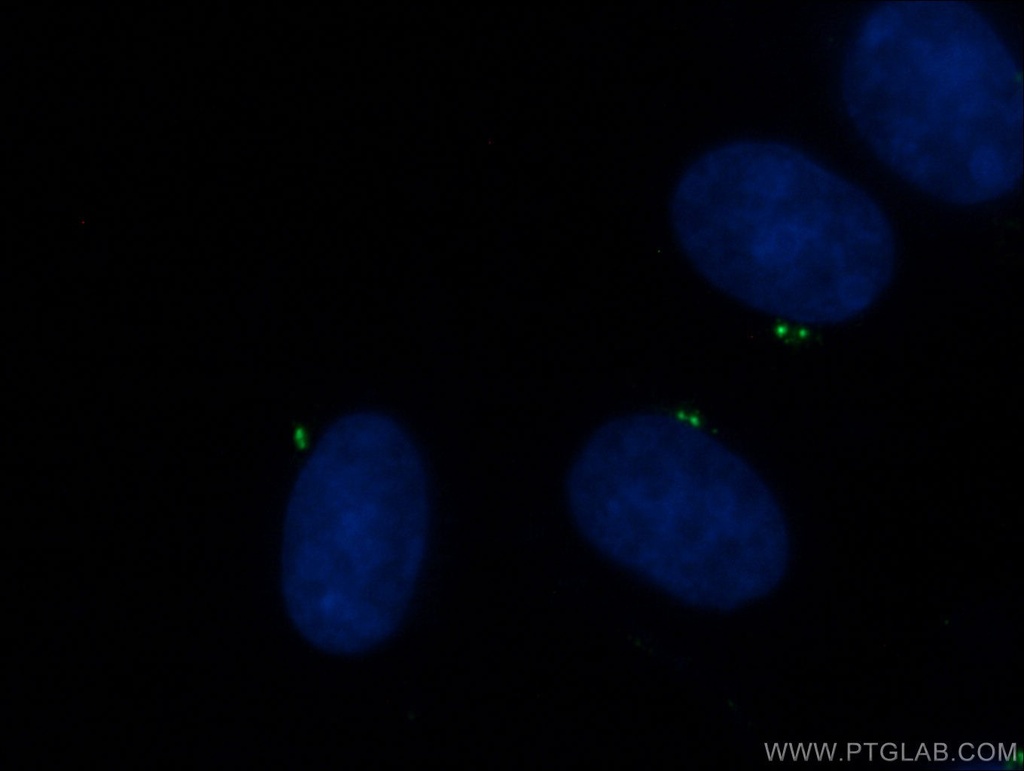CEP135 Polyclonal antibody