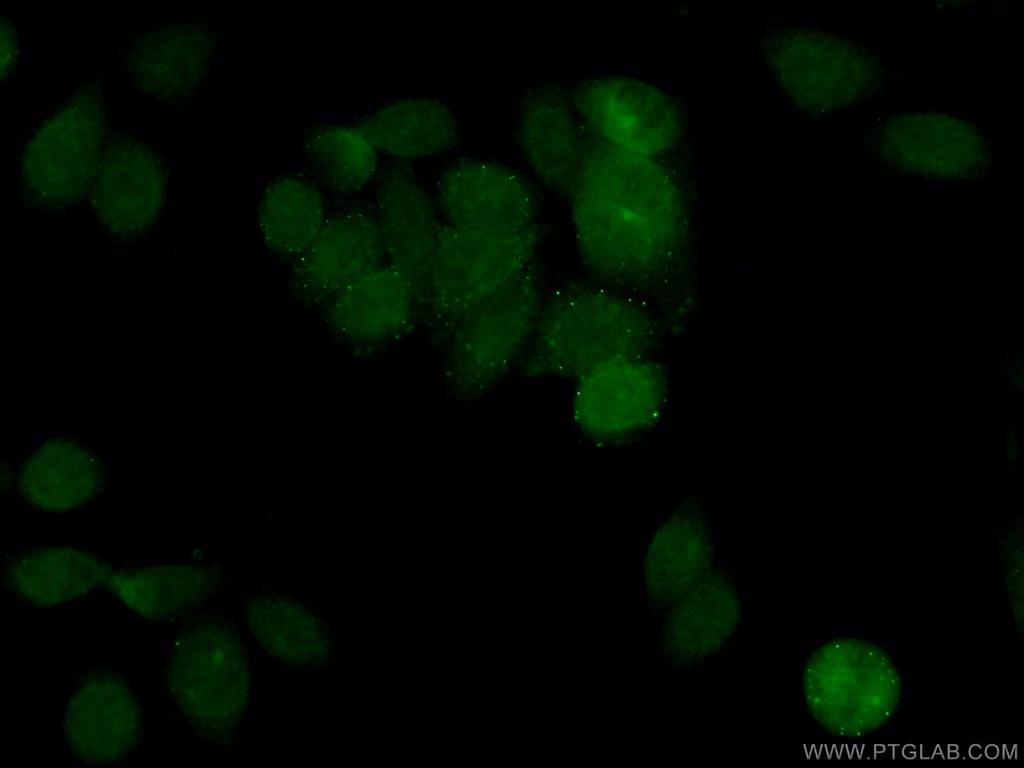 BRIP1(N-terminal) Polyclonal antibody