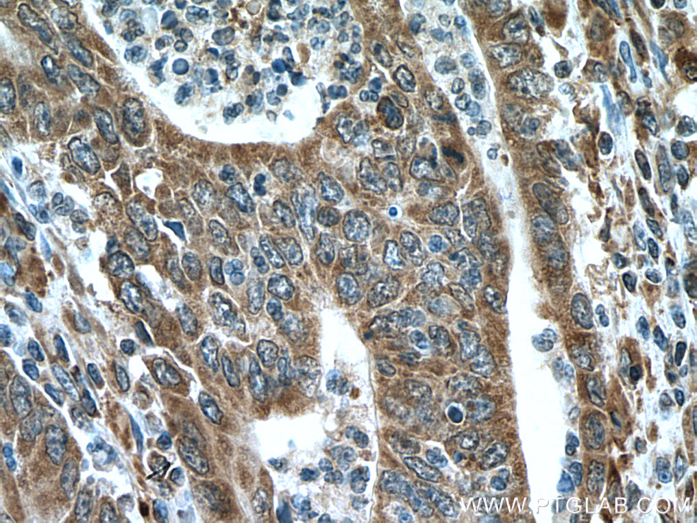 IRX6 Polyclonal antibody