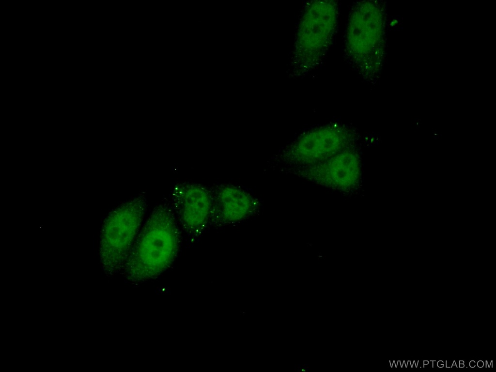 PPP1R10 Polyclonal antibody