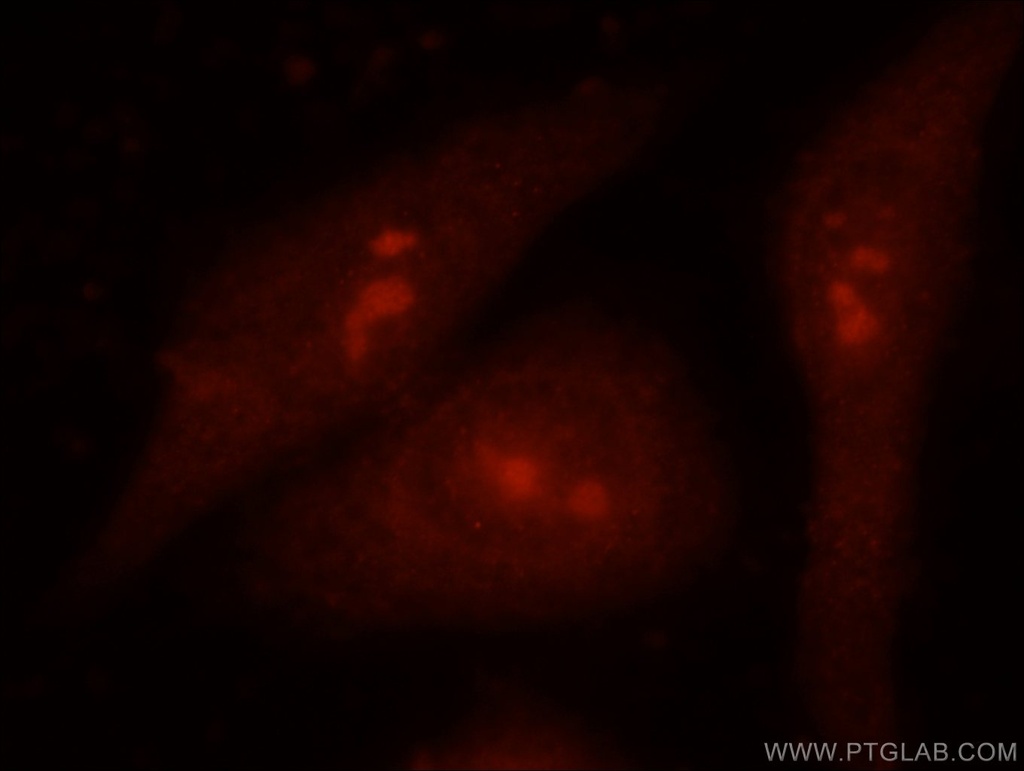 EXOSC9 Polyclonal antibody