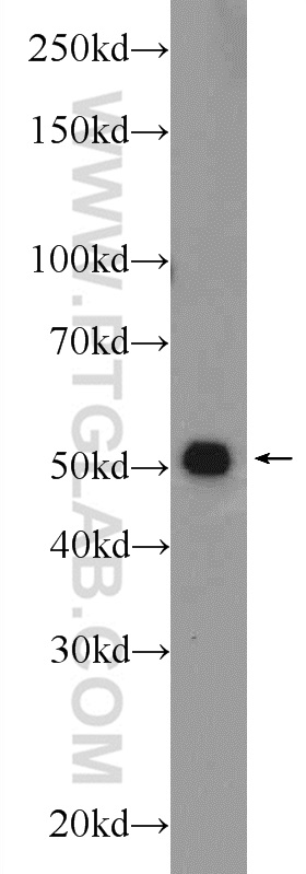 TMEM194A Polyclonal antibody
