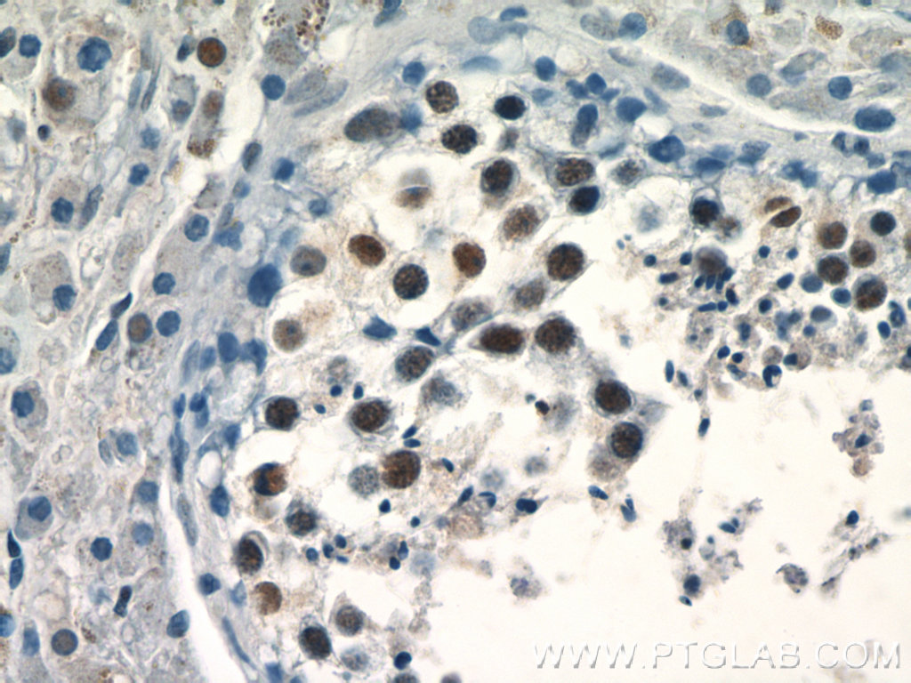 PRPF39 Polyclonal antibody