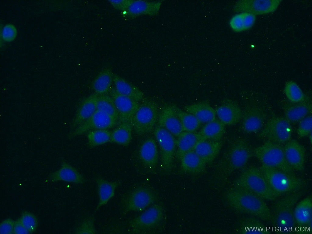 OTUD6A Polyclonal antibody