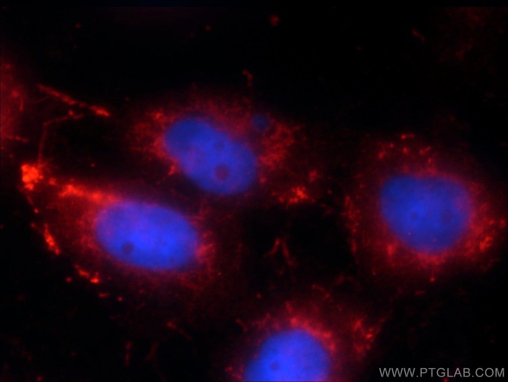 RRP7A Polyclonal antibody