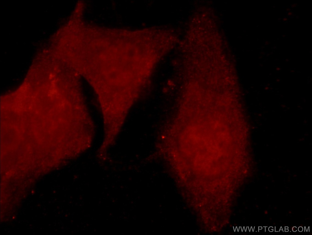 ARID4B Polyclonal antibody