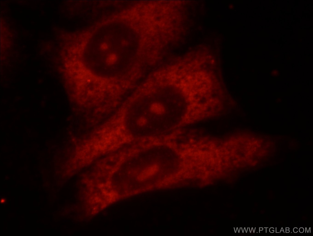 HPSE Polyclonal antibody