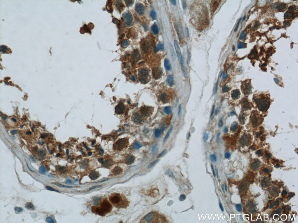 ZNF746 Polyclonal antibody