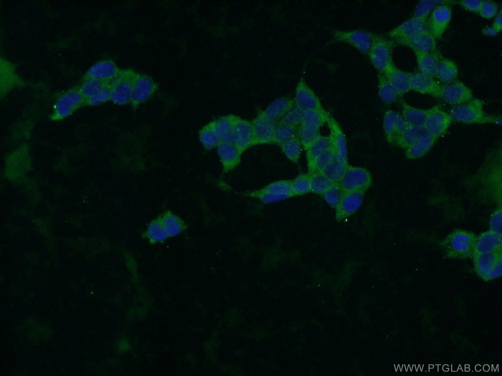 ZBTB8A Polyclonal antibody
