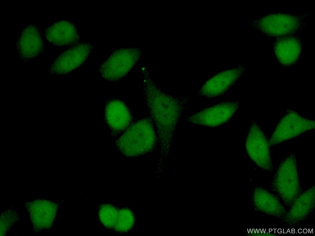 HP1BP3 Polyclonal antibody