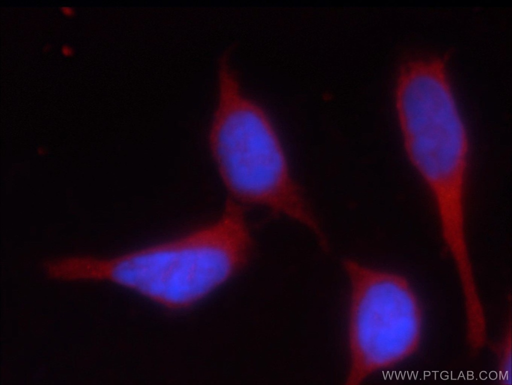 HEATR2 Polyclonal antibody