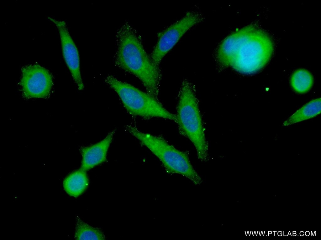 SLC37A1 Polyclonal antibody