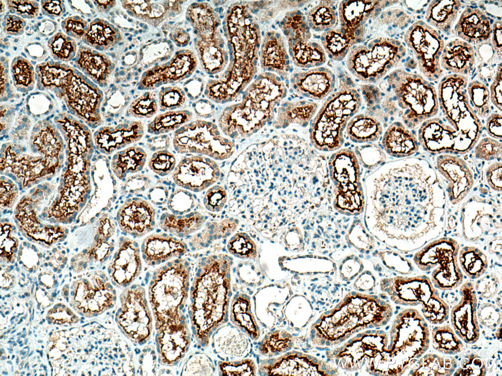 SLCO4C1 Polyclonal antibody