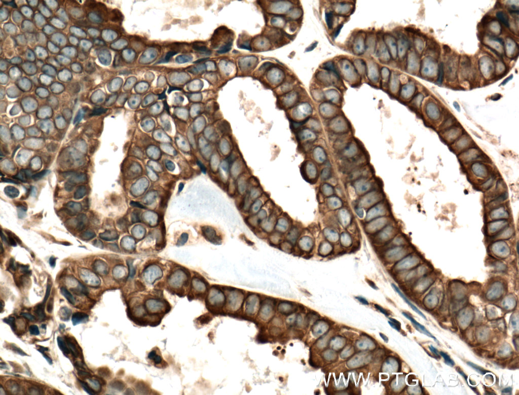 FOXRED1 Polyclonal antibody
