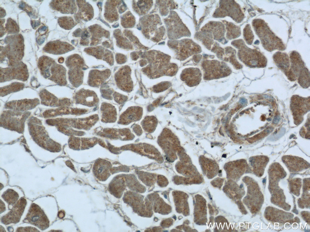 UPB1 Polyclonal antibody