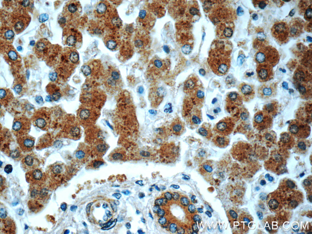 PHKA2 Polyclonal antibody
