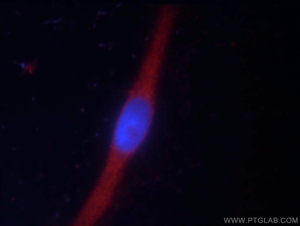 LRSAM1 Polyclonal antibody