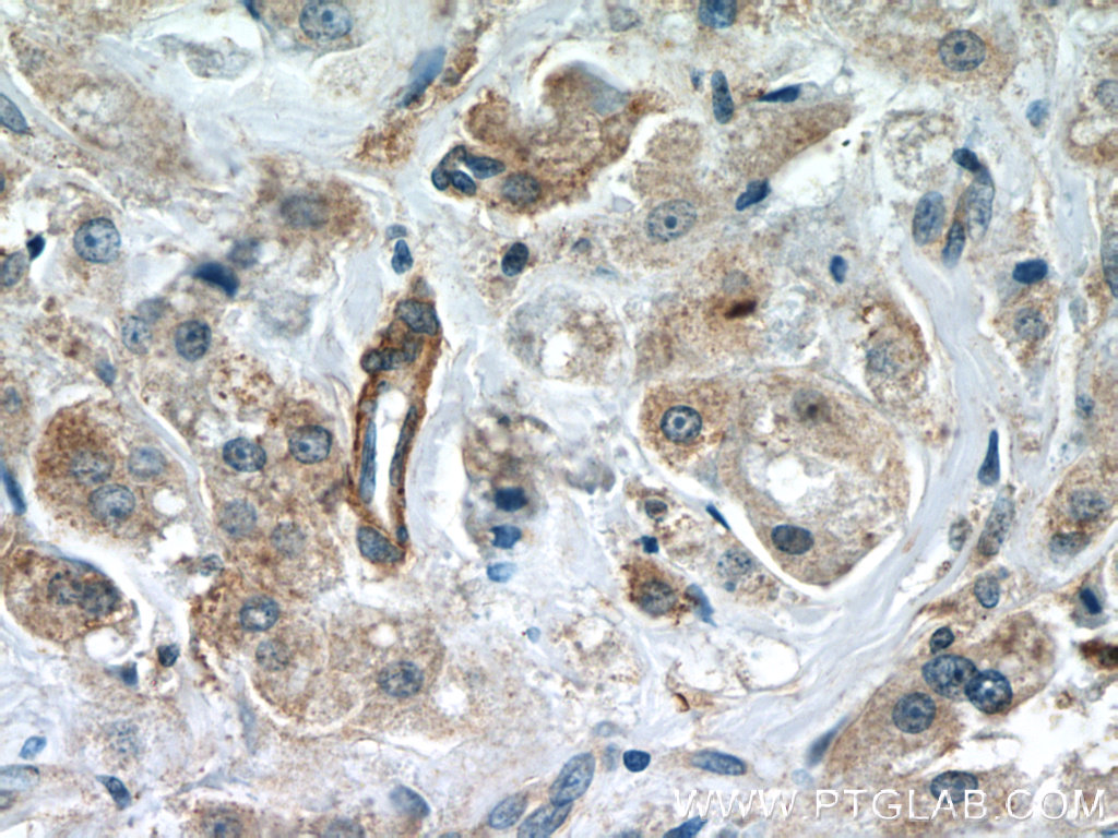 CCDC99 Polyclonal antibody