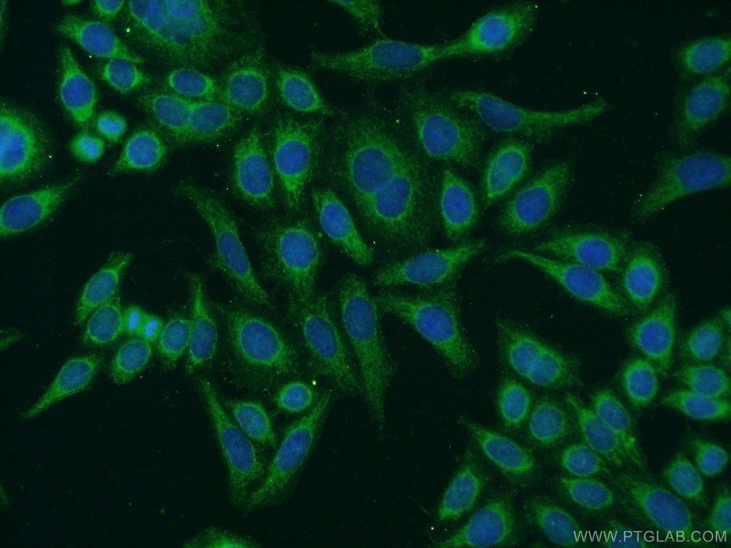 EYA4 Polyclonal antibody