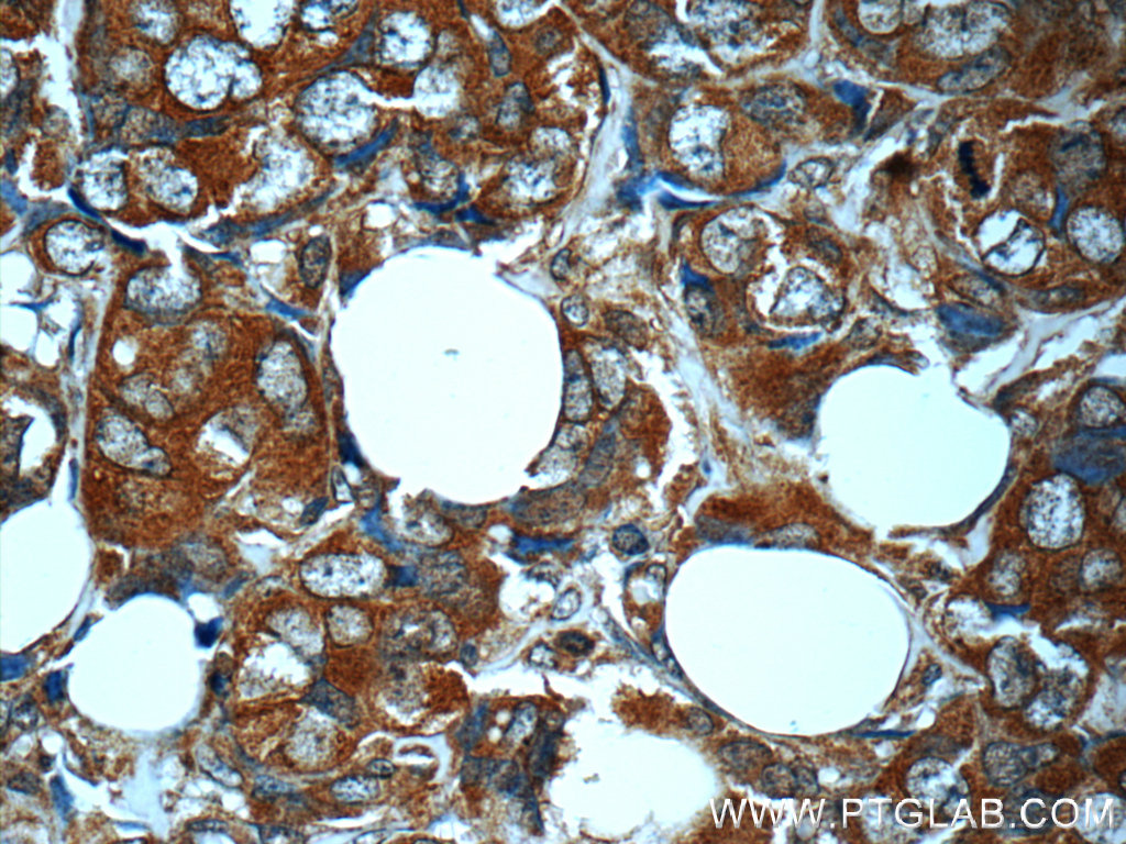MN1 Polyclonal antibody