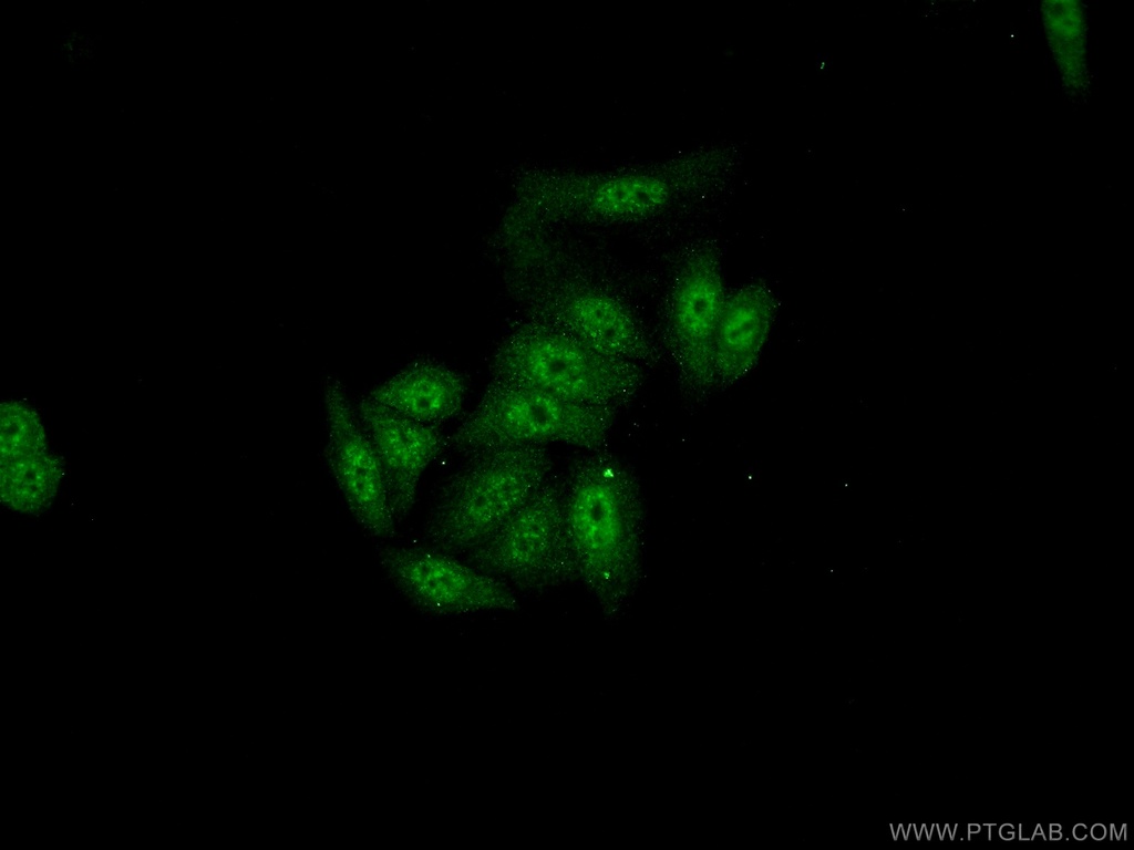 SFRS8 Polyclonal antibody