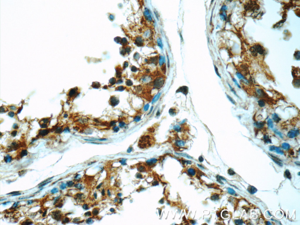 ODF1 Polyclonal antibody