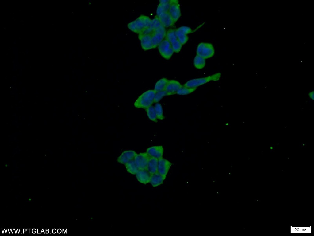 WWC2 Polyclonal antibody