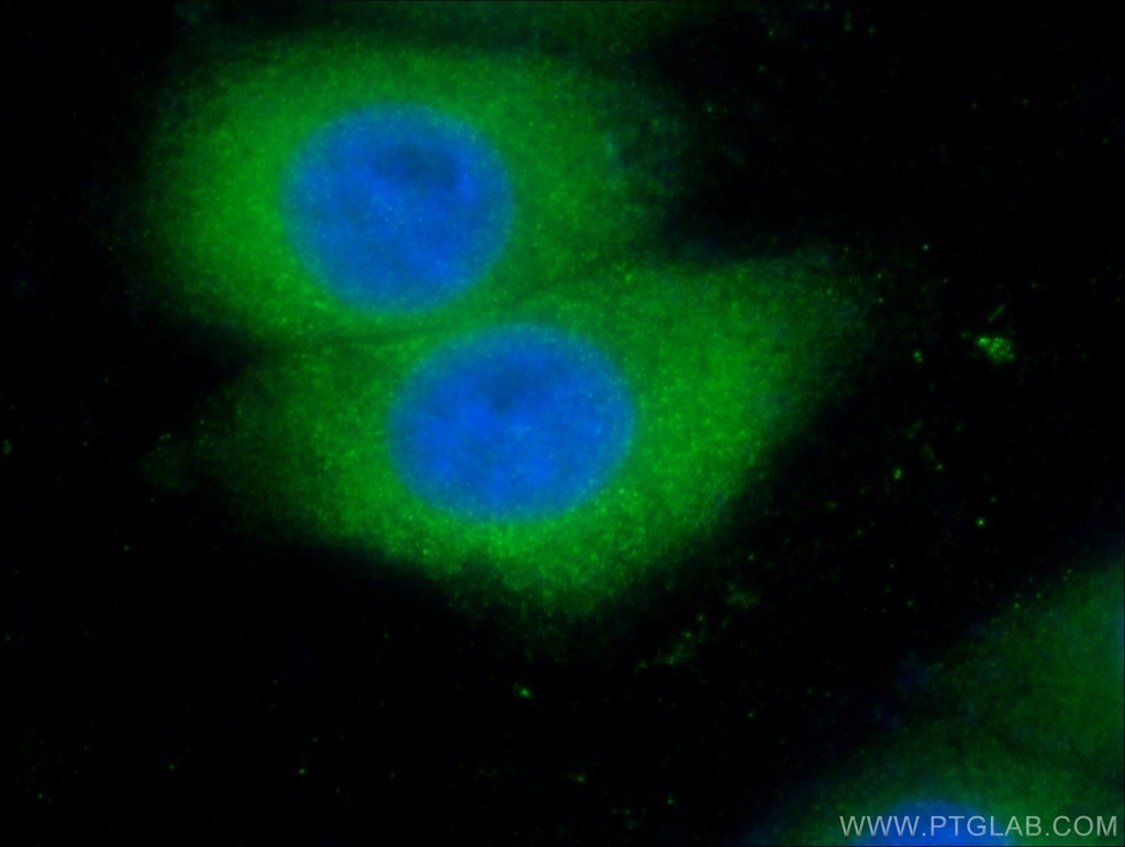 VHL Polyclonal antibody