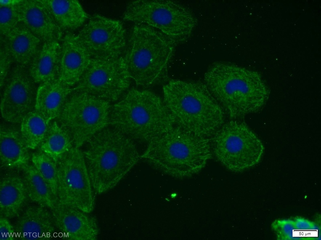TOR1AIP2 Polyclonal antibody