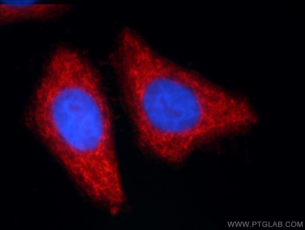 ANKS1B Polyclonal antibody