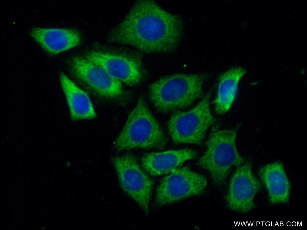 GIGYF2 Polyclonal antibody