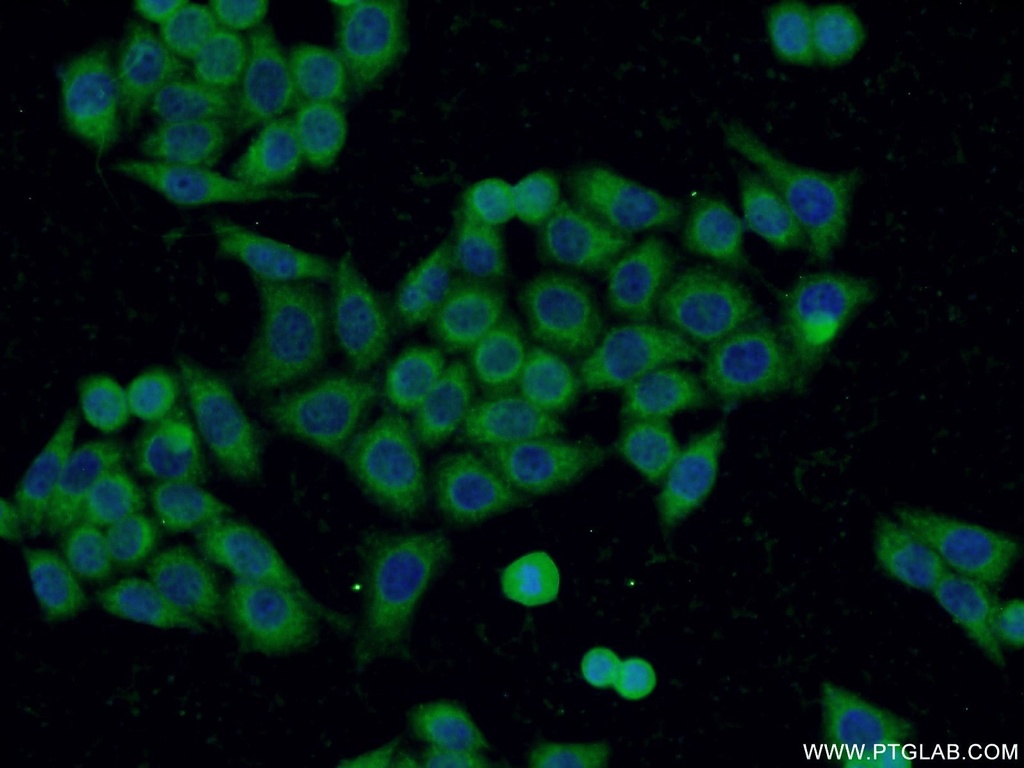 C19orf61 Polyclonal antibody